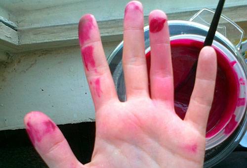 Flecken von Fucorcin auf der Hand