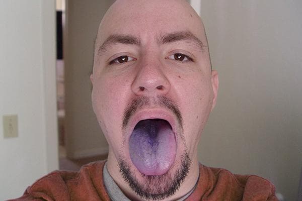 Blaue Zunge nach dem Wein