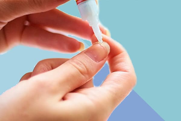Reparatur eines gebrochenen Nagels