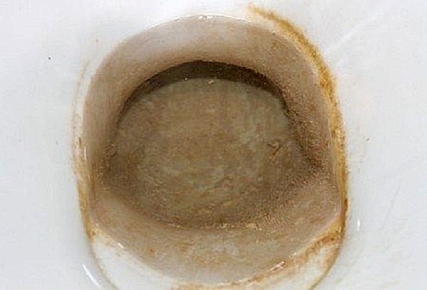Laugen mit Urinstein in der Toilette